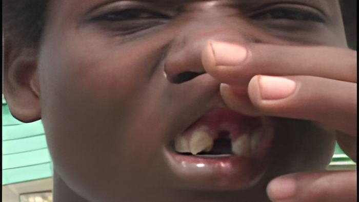 brandontooth.may24.13.jpg