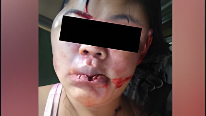 abuse.jan14.21.jpg