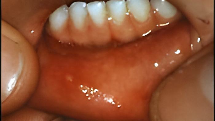 mouth22.6.12.jpg