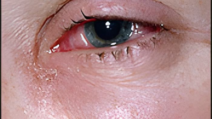 eye20.9.17.jpg