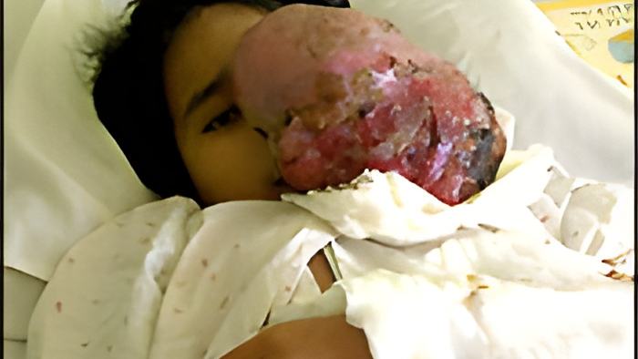 tumor30.3.12.jpg