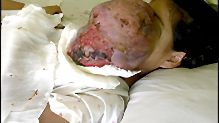 tumor23.3.12.jpg
