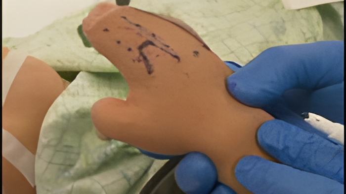 handsurgery.may10.13.jpg